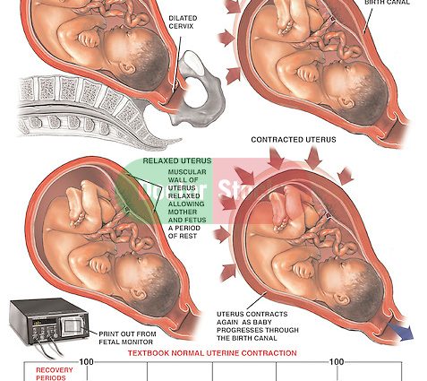 What do uterine contractions show?