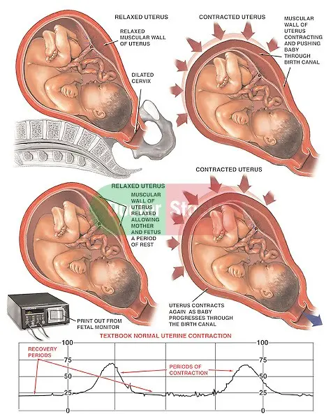 What do uterine contractions show?