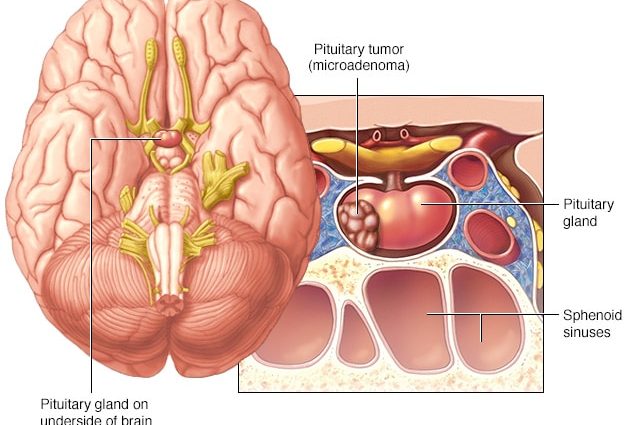 What do we know about pituitary adenomas?