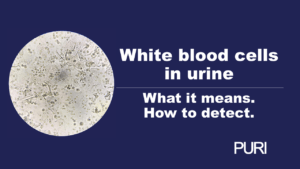 What do white blood cells in the urine show?