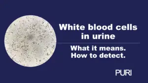 What do white blood cells in the urine show?