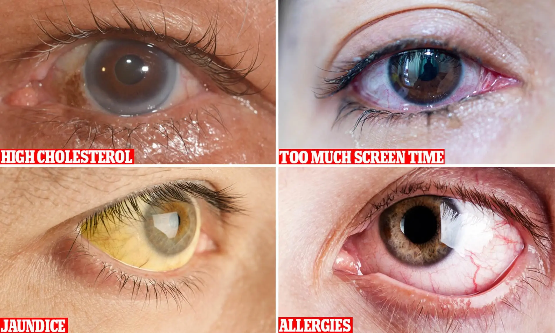 What do your eyes say about your health?