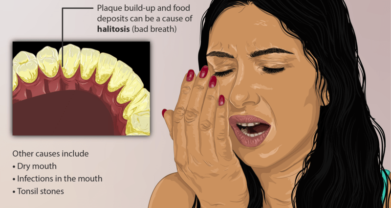 What does a bad smell from the mouth show? Eight diseases that cannot be taken lightly