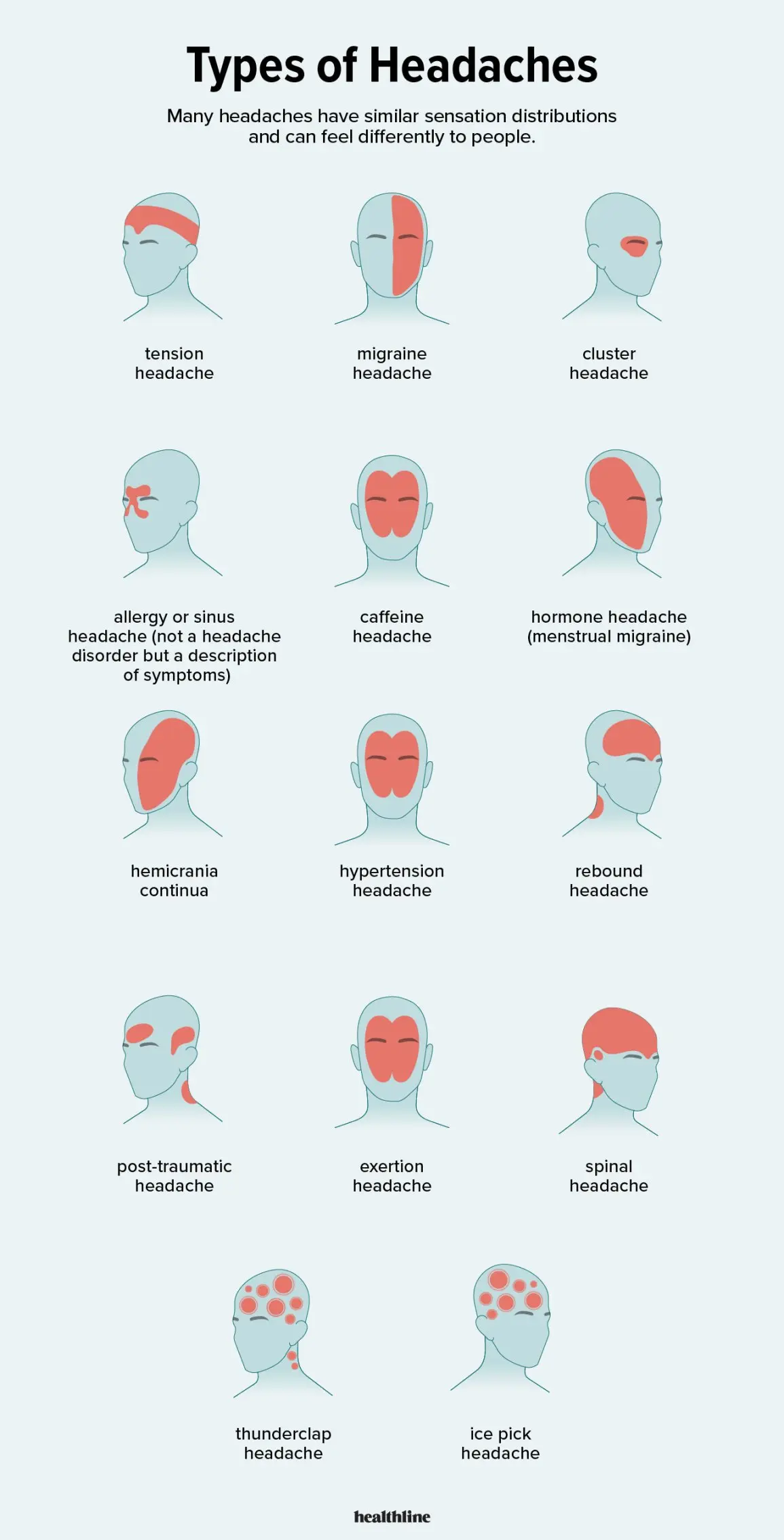 What does a headache on the tip mean? Causes, diagnosis, treatment