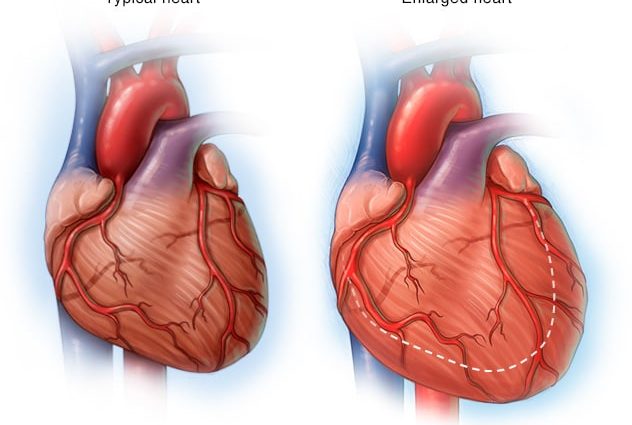 What does an enlarged heart show?