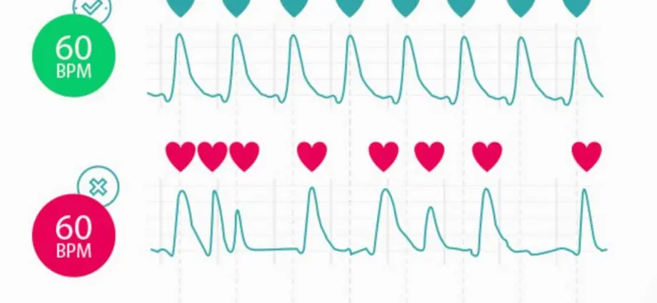 What does an uneven heartbeat show?