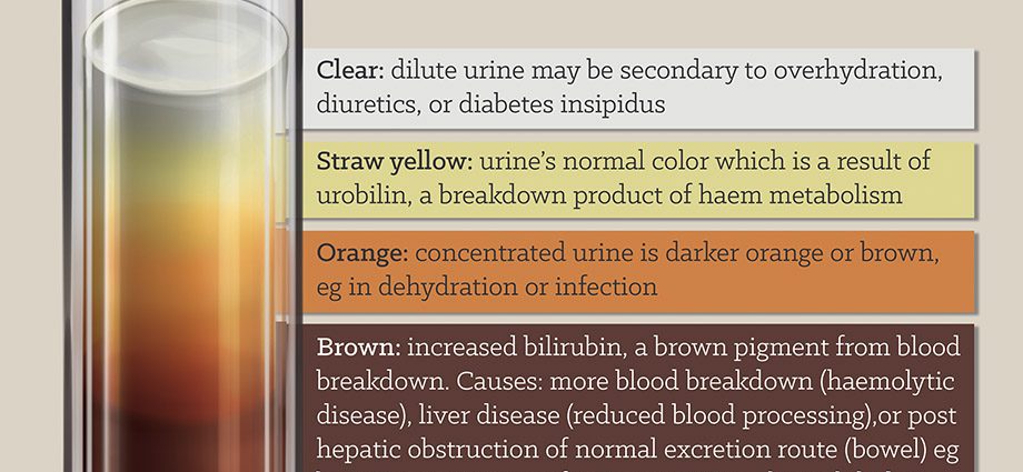 What does brown urine show?