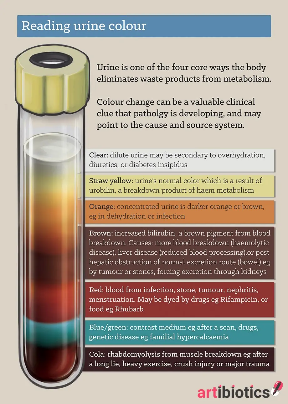 What does brown urine show?