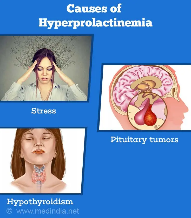 What does high prolactin prove?