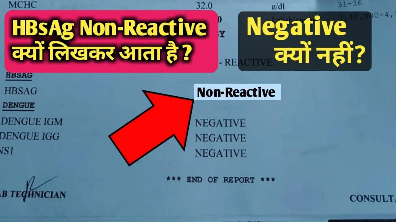 What does non-reactive HCV mean in test results?