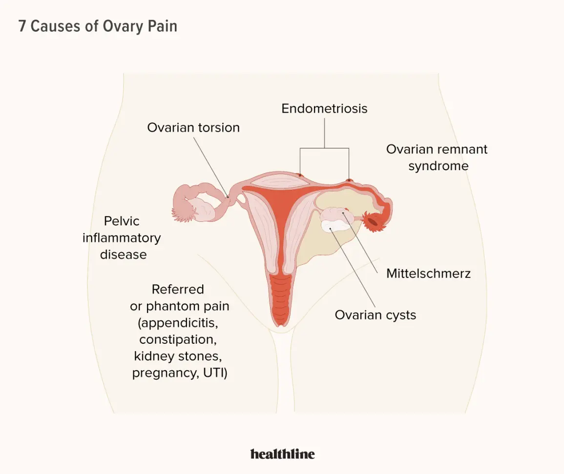 What does ovarian pain in pregnancy mean? The most common causes