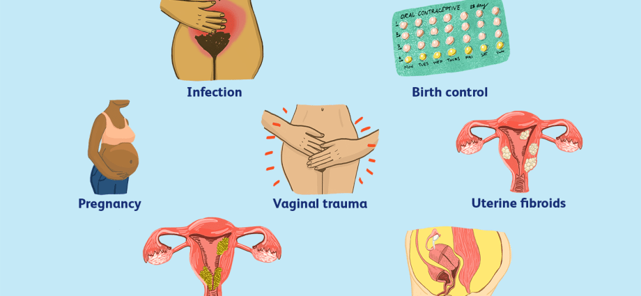 What does post-period spotting mean? Find out about the most common causes of spotting