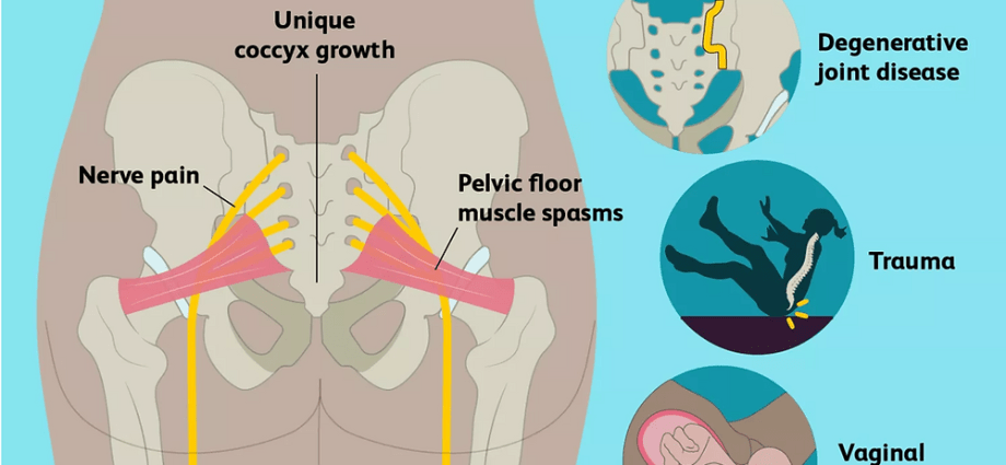 What does tailbone pain in pregnancy show?