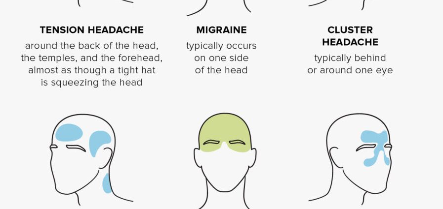 What does the headache in front show?