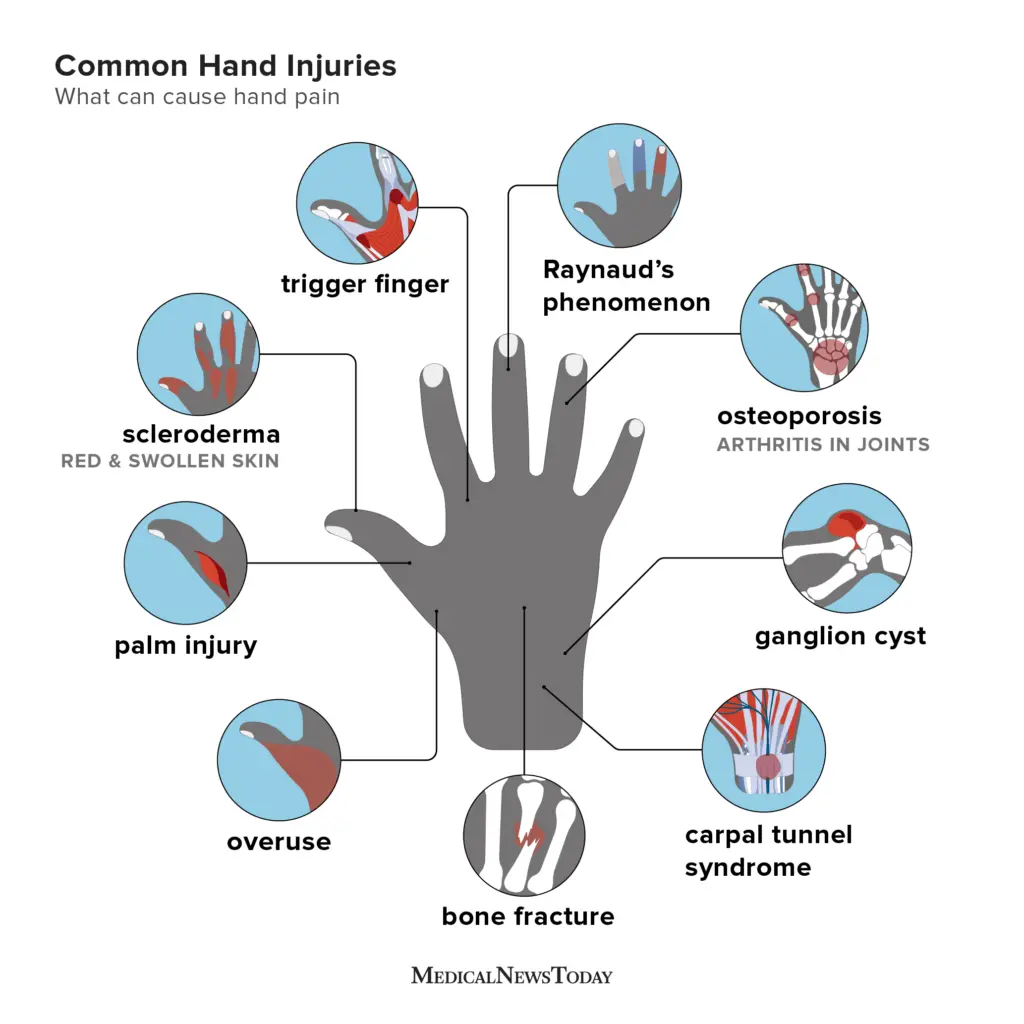 What does the pain in the left hand show?