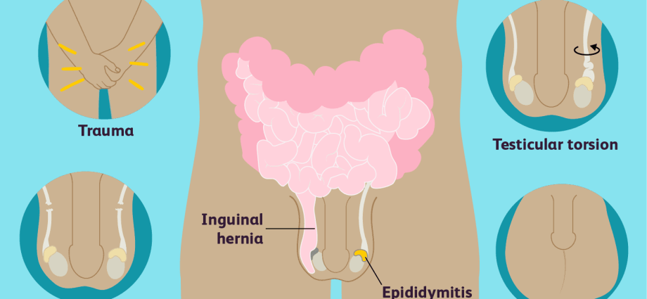 What does the pain in the left testicle show?