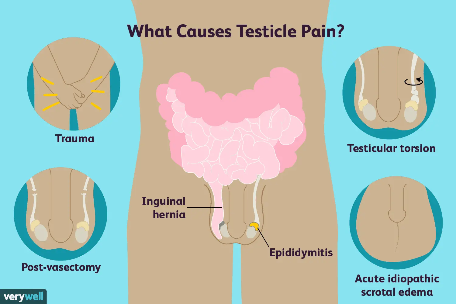 What does the pain in the left testicle show?