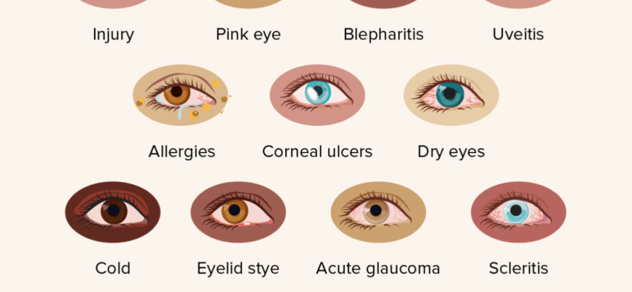 What does the red spot on the eye show?