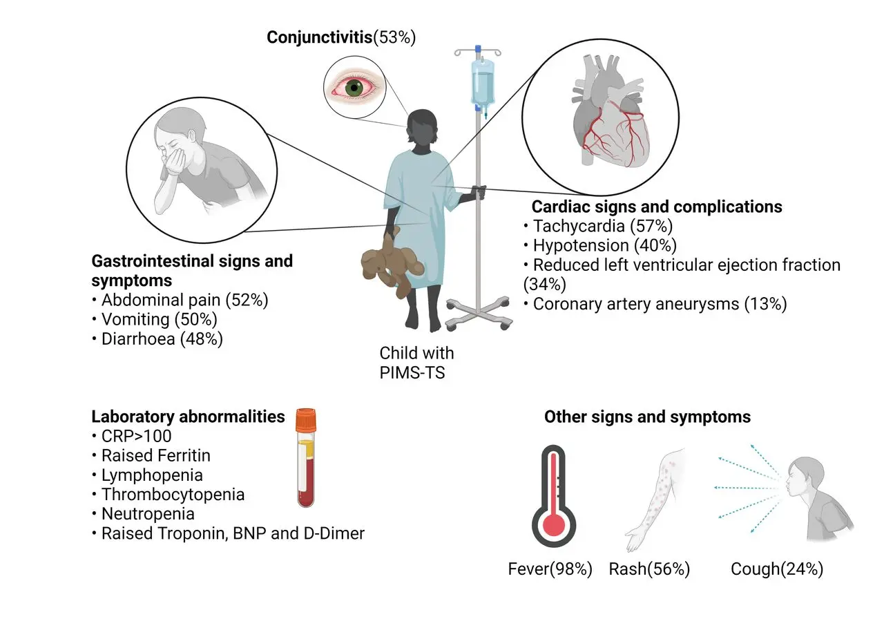 What happens to children who have had COVID-19? A new study on PIMS