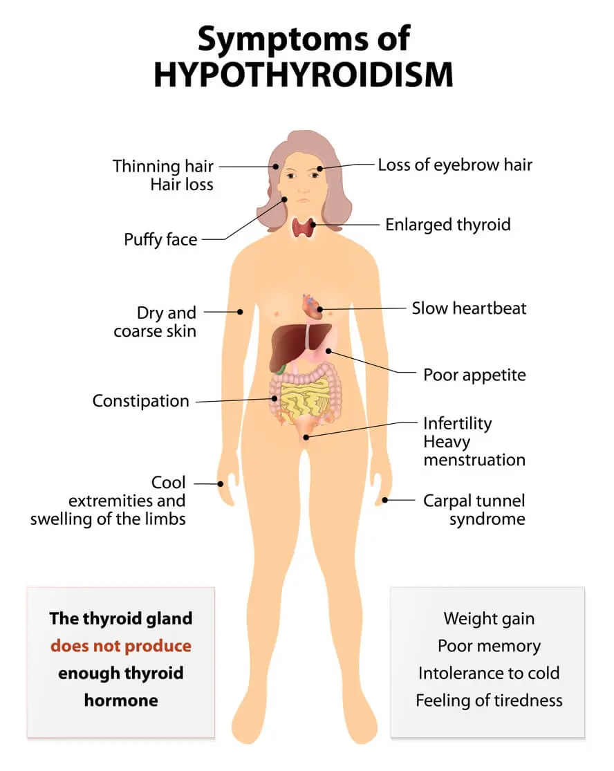 What happens when the thyroid gland is sick? Hashimoto &#8211; piece of a larger puzzle