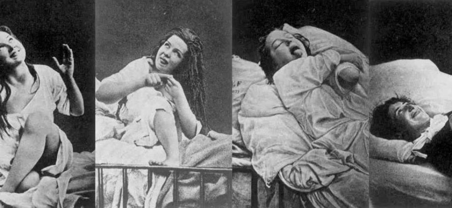 What is hysteria? Symptoms, causes, treatment of hysteria