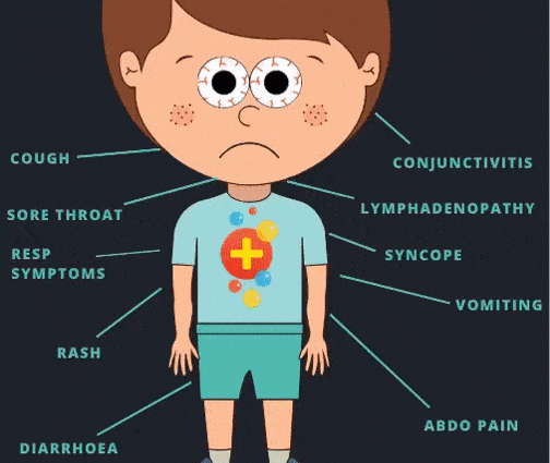 What is PIMS? The disease affects children who have had COVID-19. Here are the symptoms