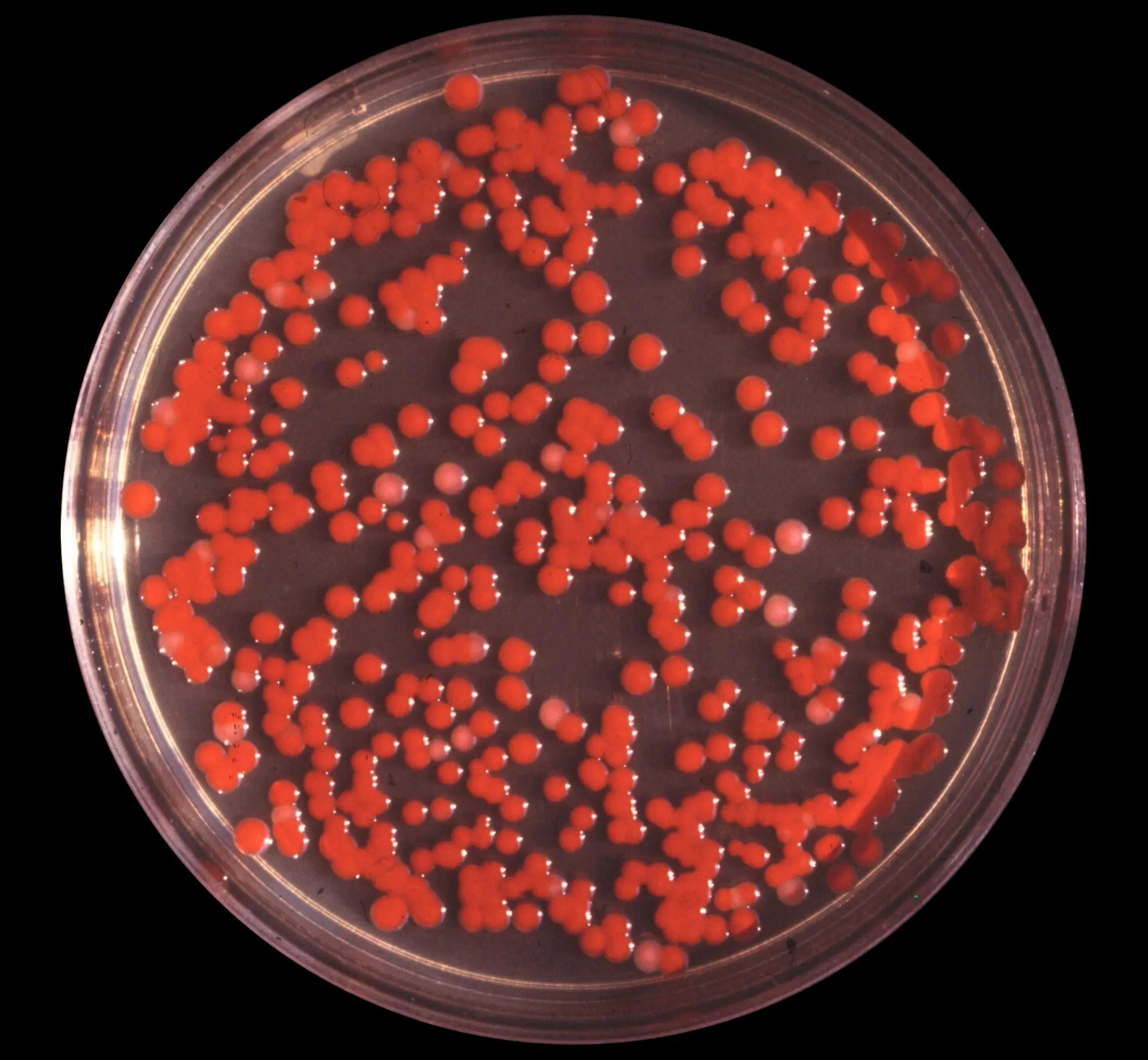 What is serratia marcescens?