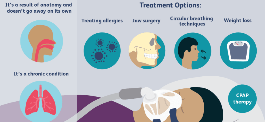 What is sleep apnea and how to treat it?