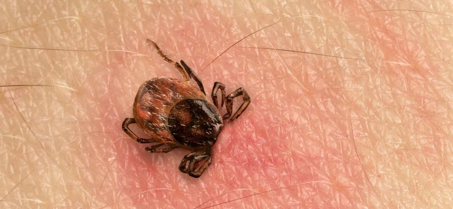 What is the most effective way to get rid of a tick? The French veterinarian&#8217;s &#8220;slit plus rotation&#8221; method is quick and simple