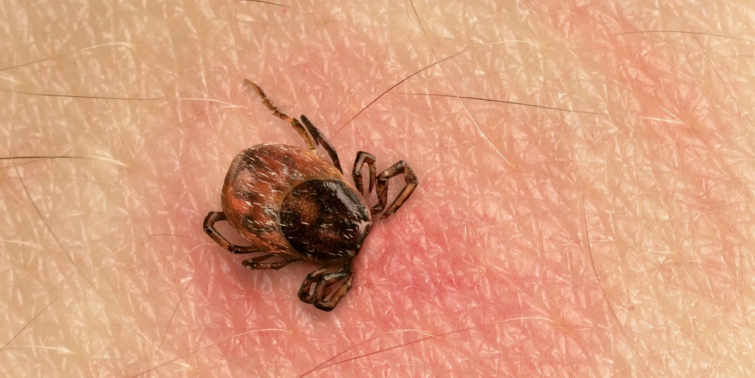 What is the most effective way to get rid of a tick? The French veterinarian&#8217;s &#8220;slit plus rotation&#8221; method is quick and simple