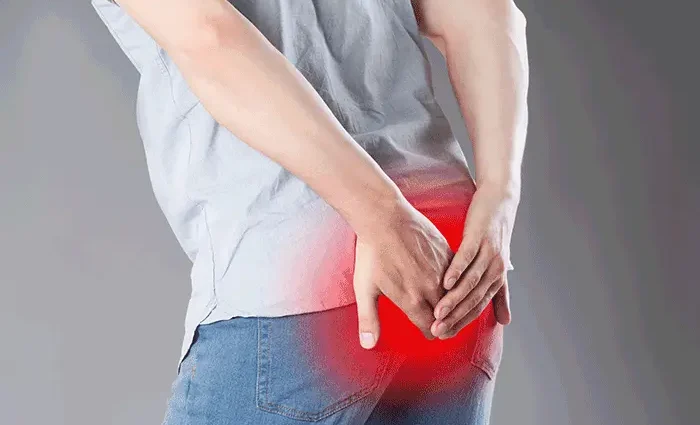 What is the root of the pain in the anus?