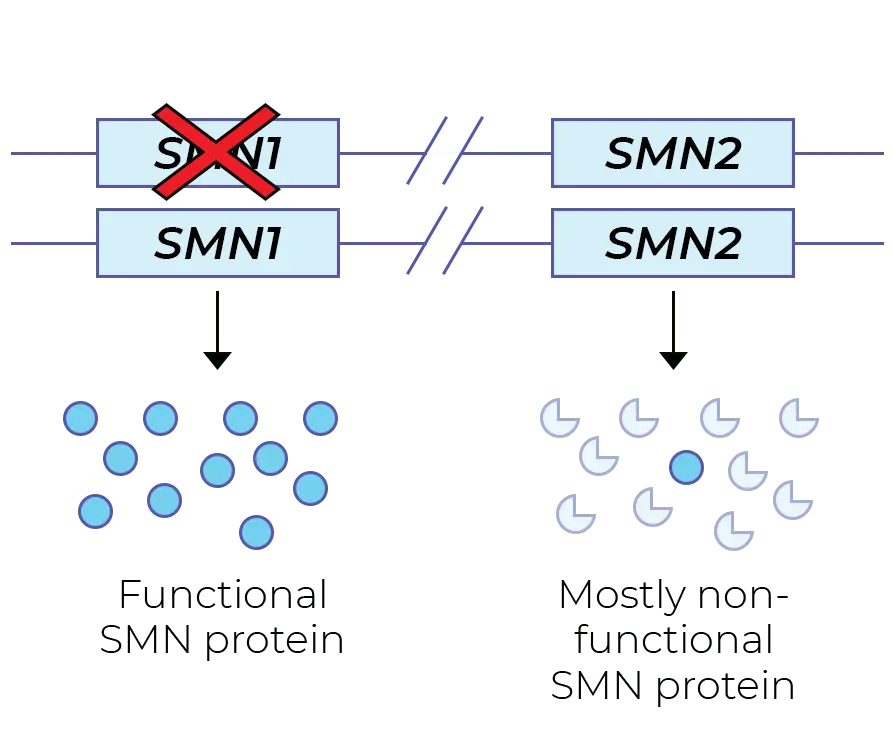 What is the treatment of SMA in Poland? We are a leader, but we need screening