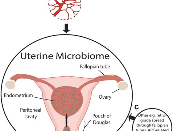 What is uterine ansection?