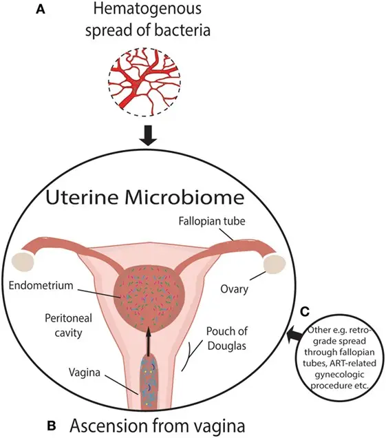 What is uterine ansection?