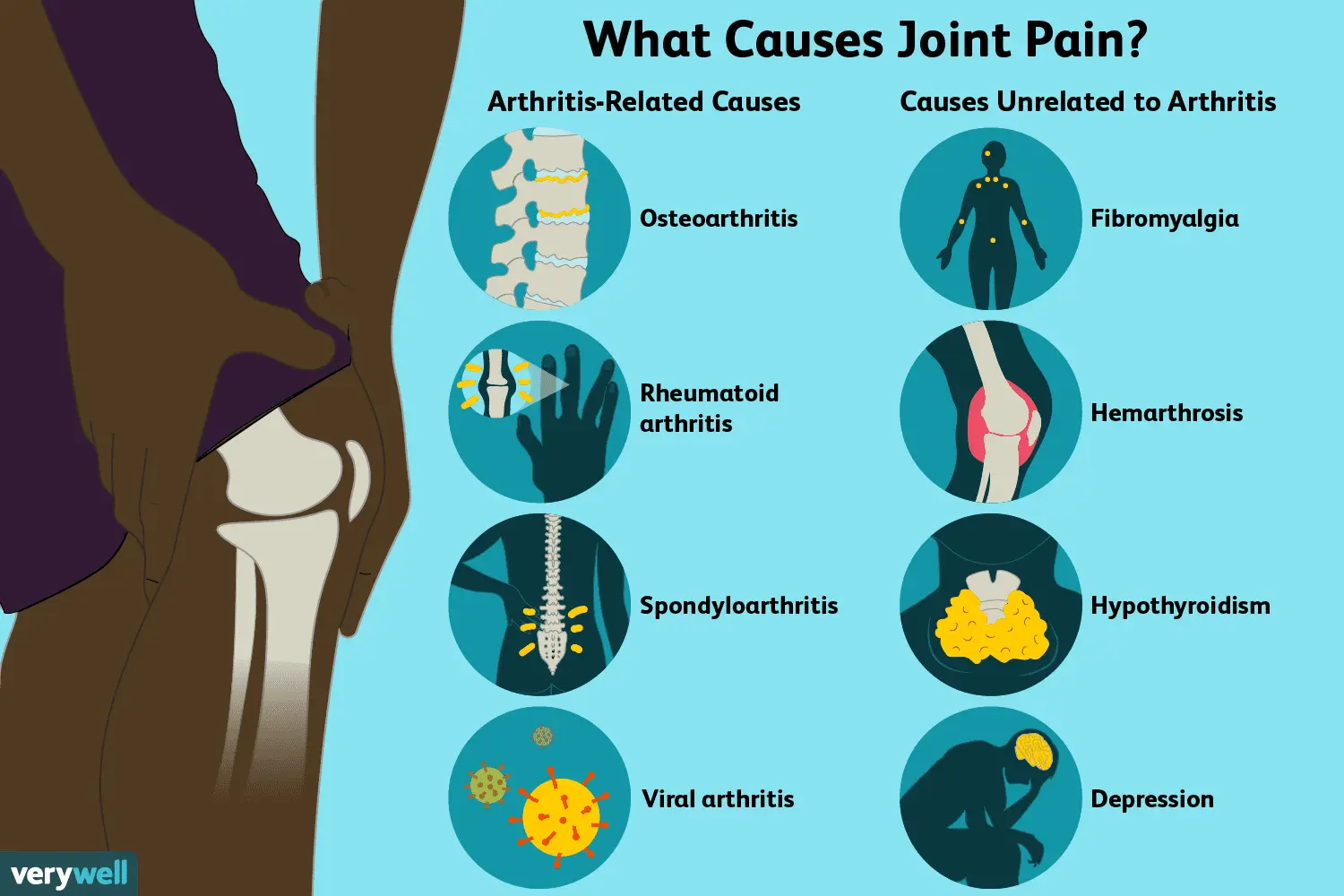 What is wrong with the joints?