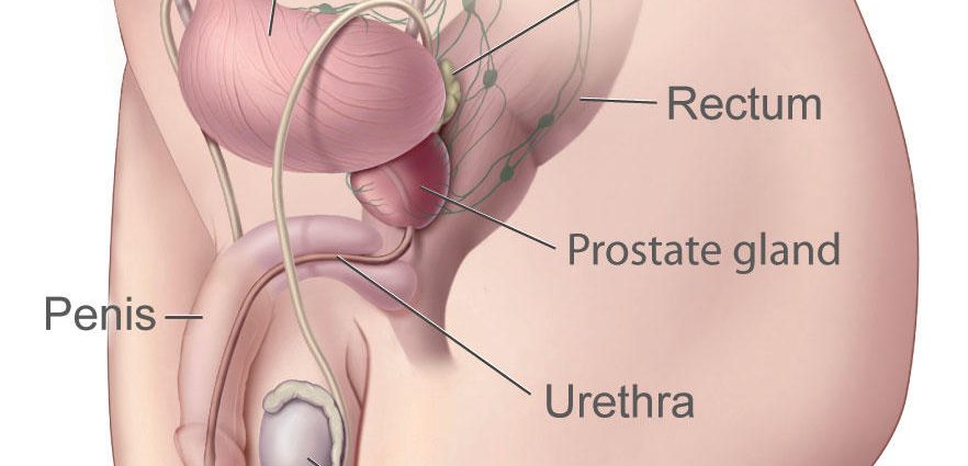 What should be changed in the prostate cancer care system?