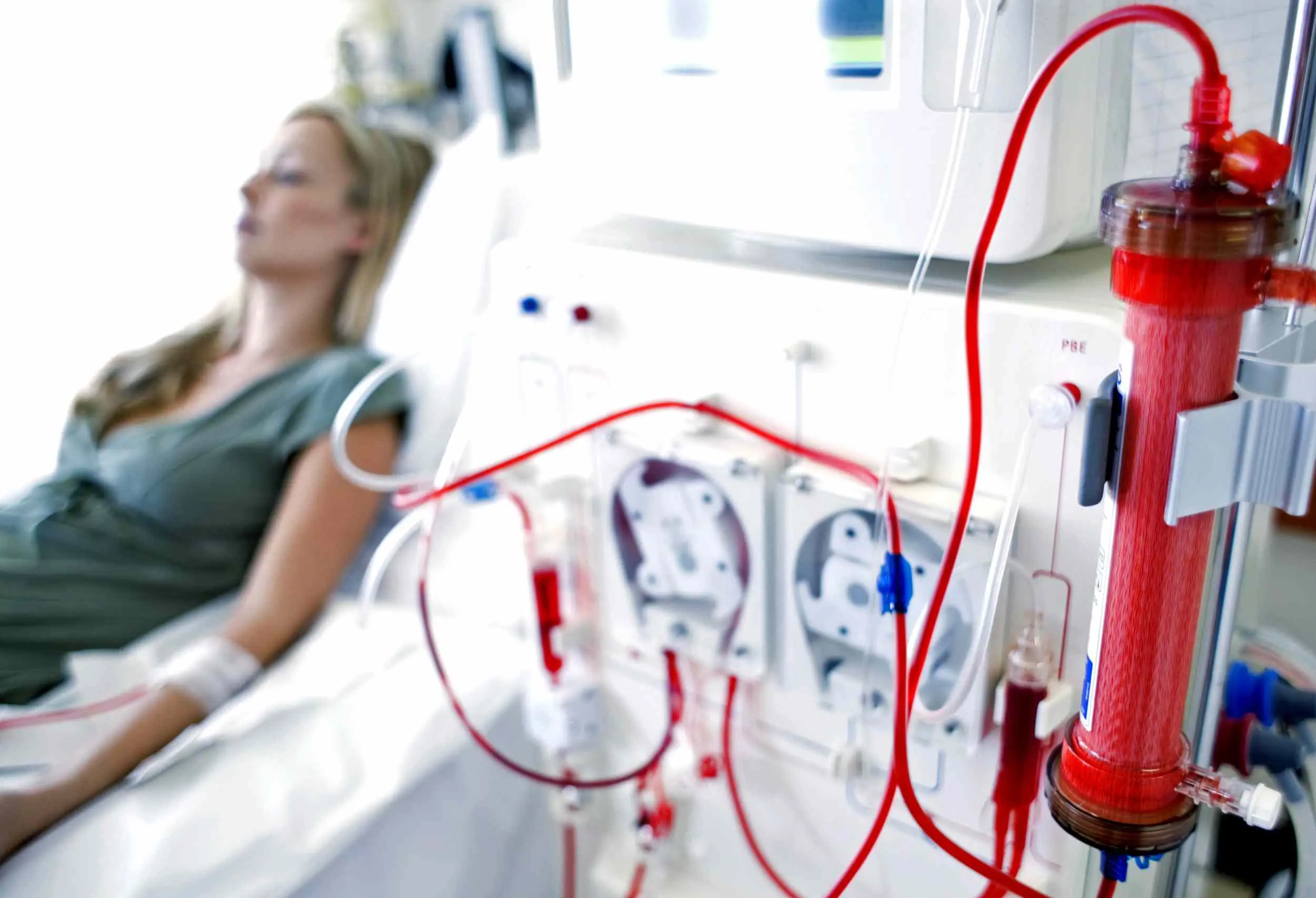 What should we know about dialysis? Checking!