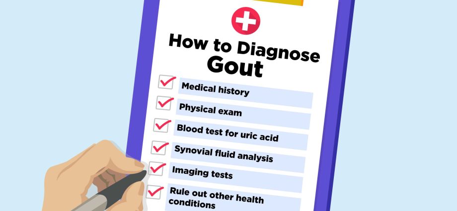 What tests for gout should be performed?