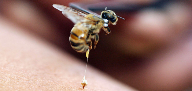 What to do if a bee has bitten in the head, eye, neck, hand, finger, leg