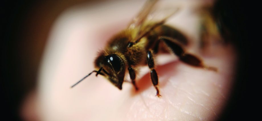 What to do if a bee has bitten in the head, eye, neck, hand, finger, leg