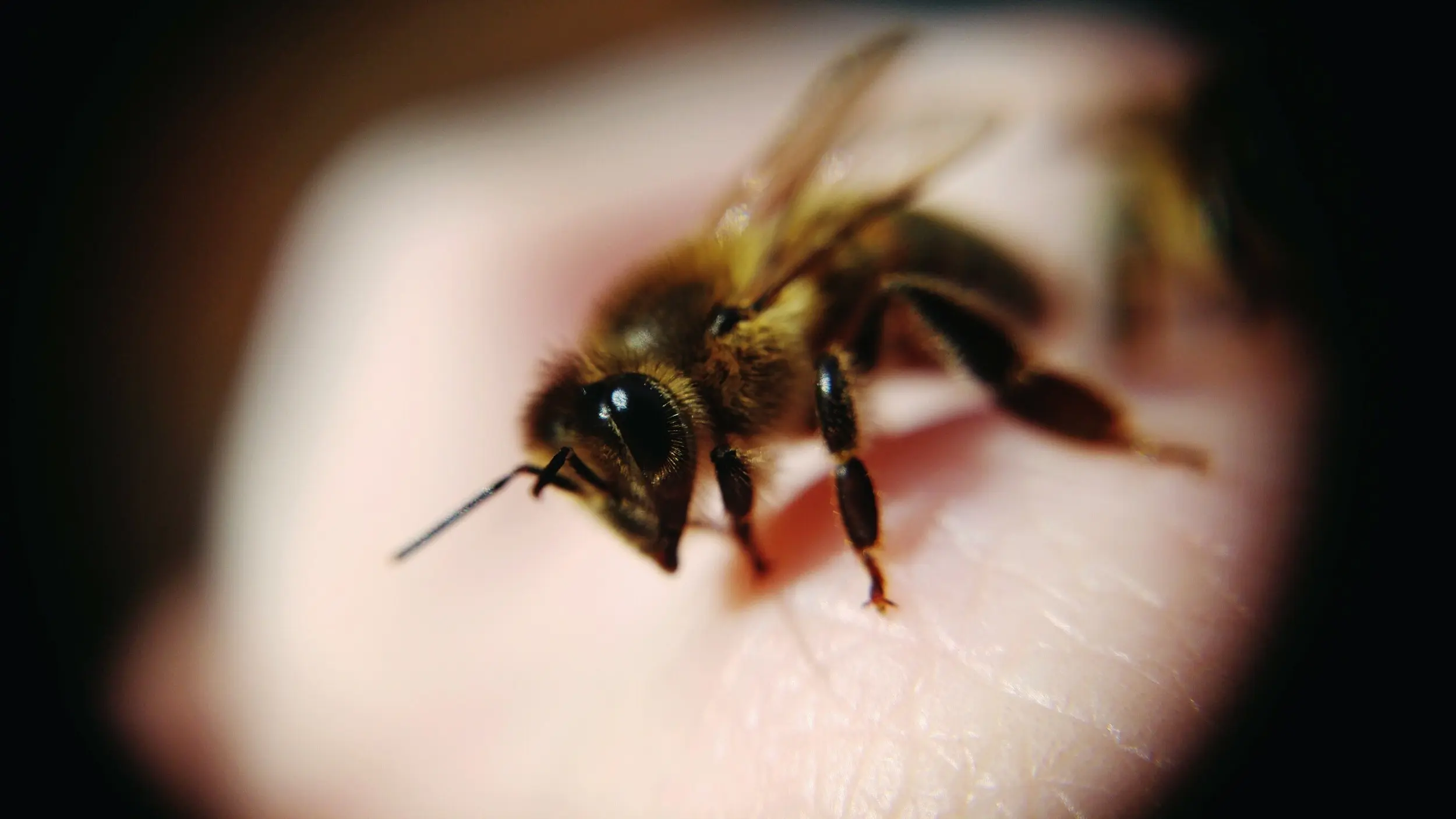 What to do if a bee has bitten in the head, eye, neck, hand, finger, leg