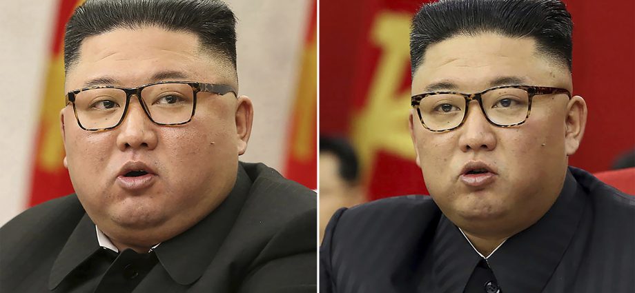 What&#8217;s up with Kim Jong Un? He has clearly lost weight, may have heart problems