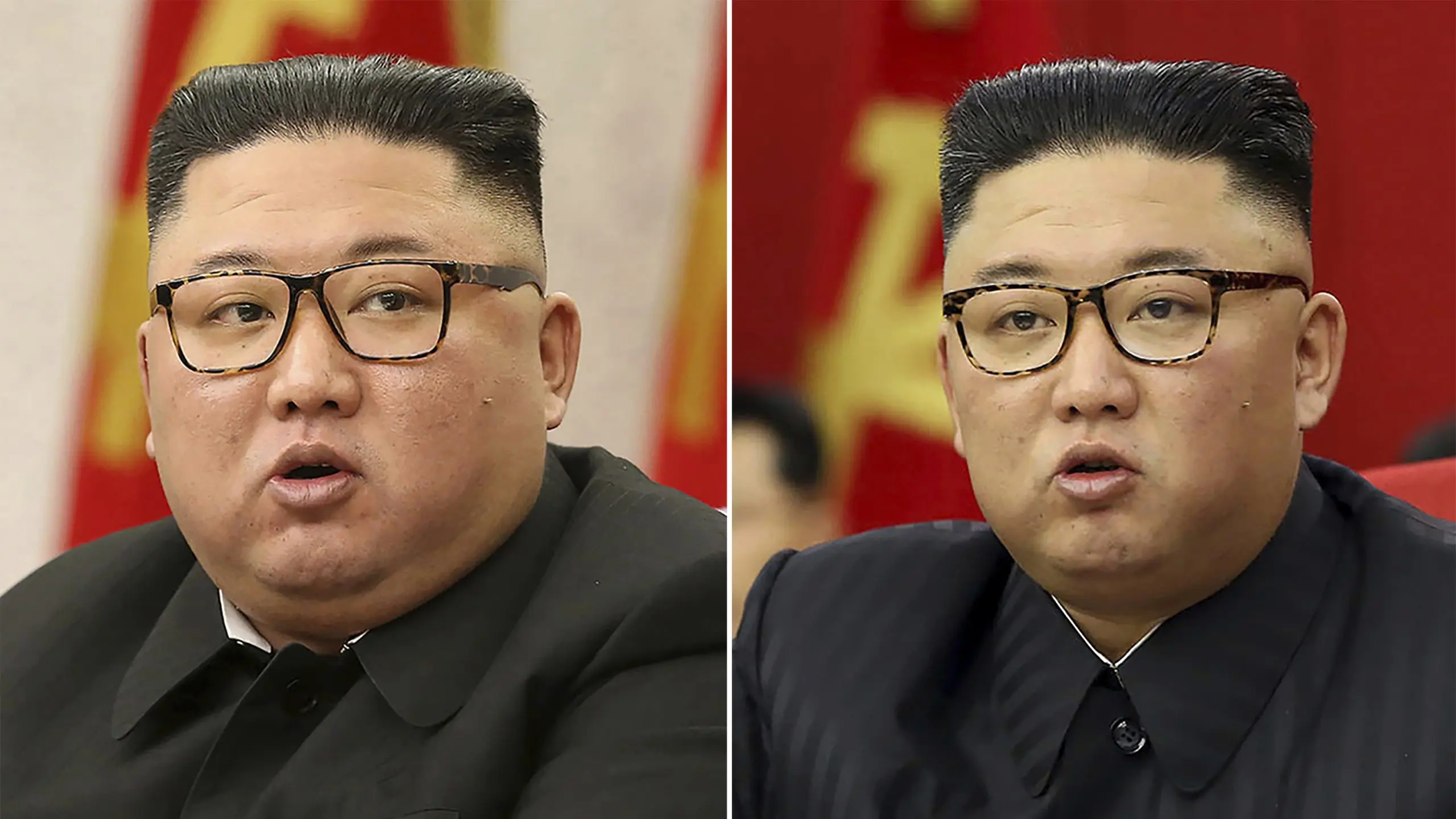 What&#8217;s up with Kim Jong Un? He has clearly lost weight, may have heart problems