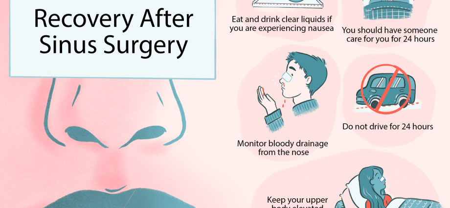 When is sinus surgery a must? Indications, course, price of the procedure