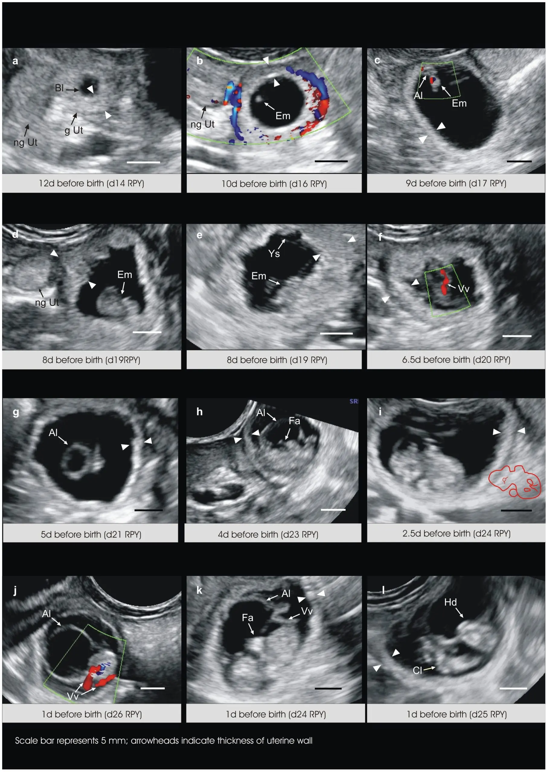 When is the pregnancy vesicle visible?