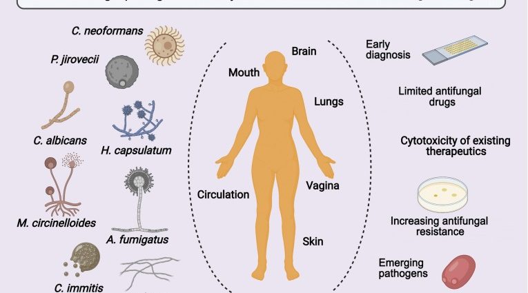 Where can you get infected with mycosis