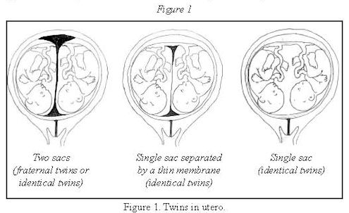 Where do twins and triplets come from?