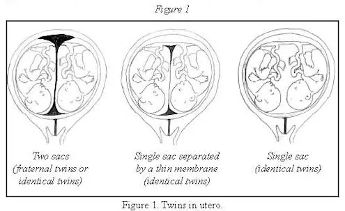 Where do twins and triplets come from?