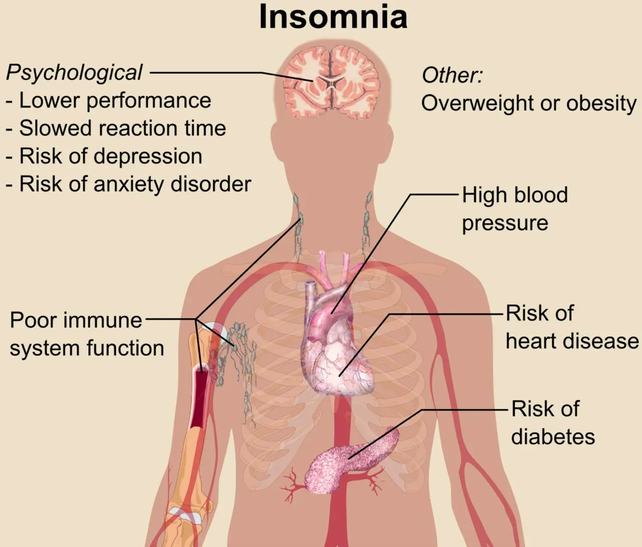 Where does insomnia come from? Find out why you can&#8217;t sleep