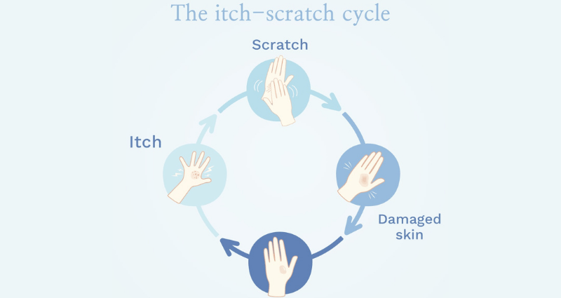 Where does itchy skin in the evening come from?